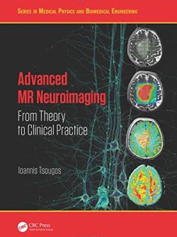 Advanced MR Neuroimaging: From Theory to Clinical Practice – Ioannis Tsougos – eBook