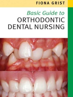 Basic Guide to Orthodontic Dental Nursing – eBook PDF