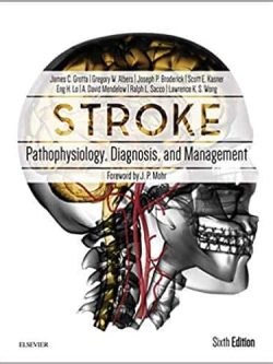 Stroke: Pathophysiology, Diagnosis, and Management (6th Edition) – eBook PDF